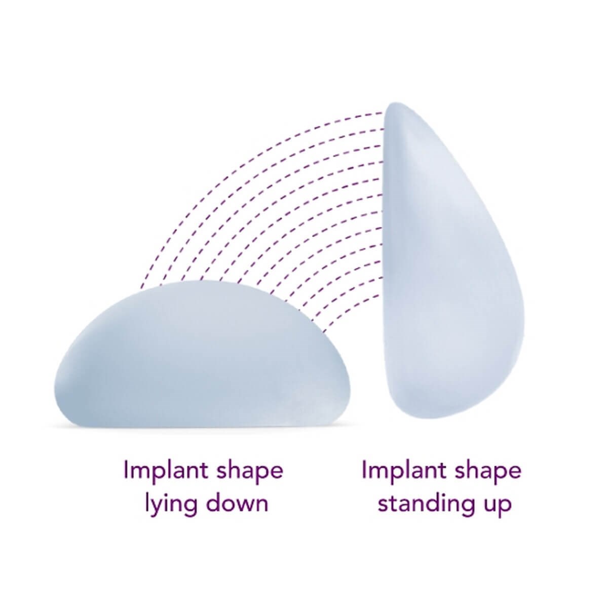Motiva implants with Dr Michae